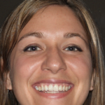 Ολυμπία Ροδίτη